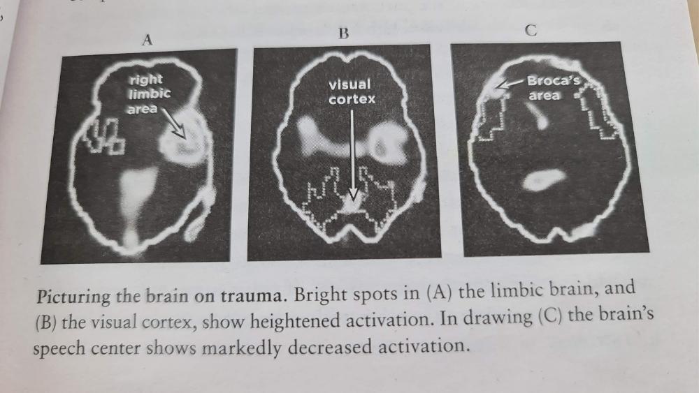 Your Brain On Trauma The Brocas Area